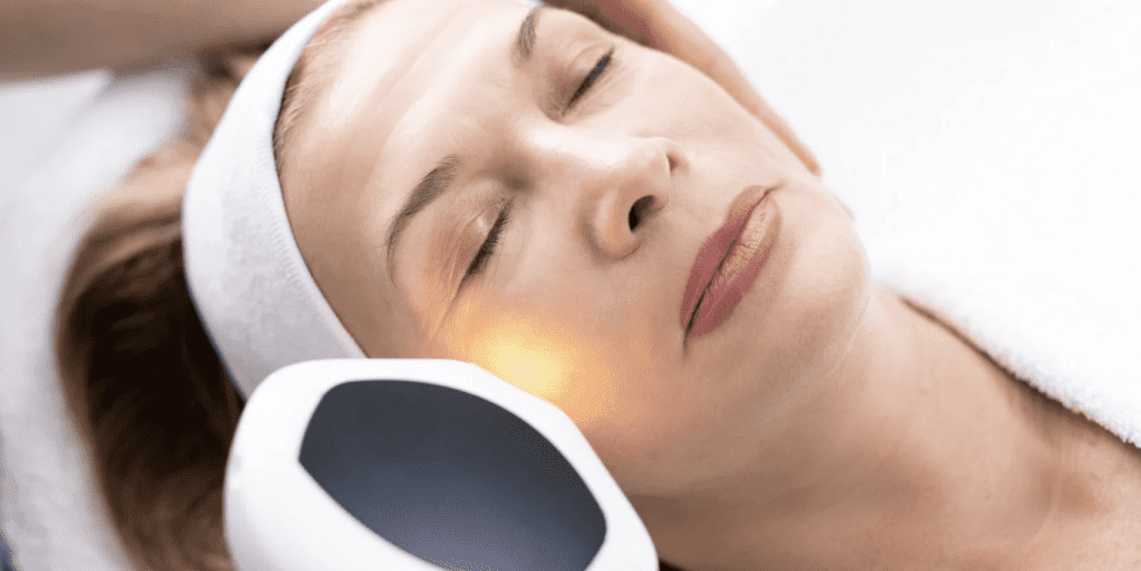 Laser Rejuvenation in Wildomar California